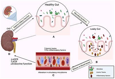 The Human Microbiome in Chronic Kidney Disease: A Double-Edged Sword